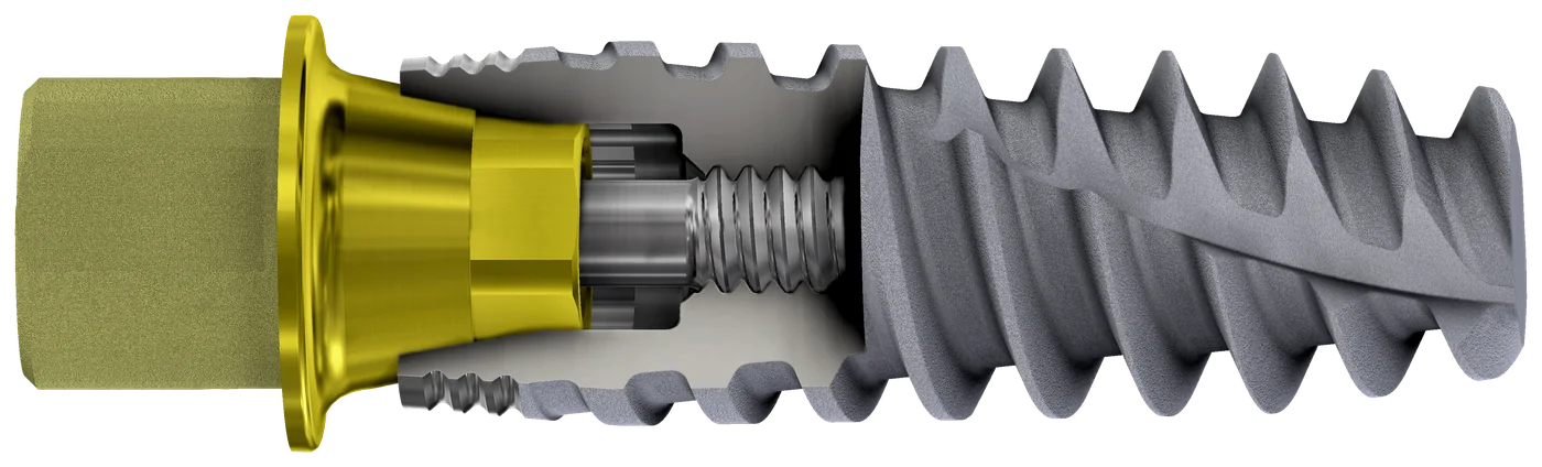 Vue en coupe d'un implant Active Hex avec sa Ti Base et sa vis
