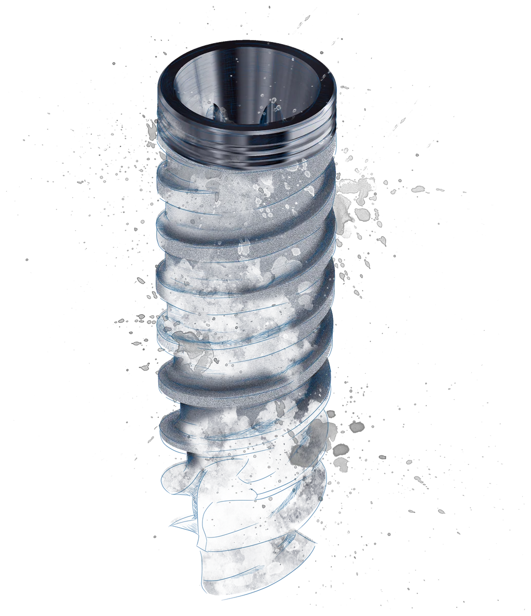 Implant DESS Active Hex